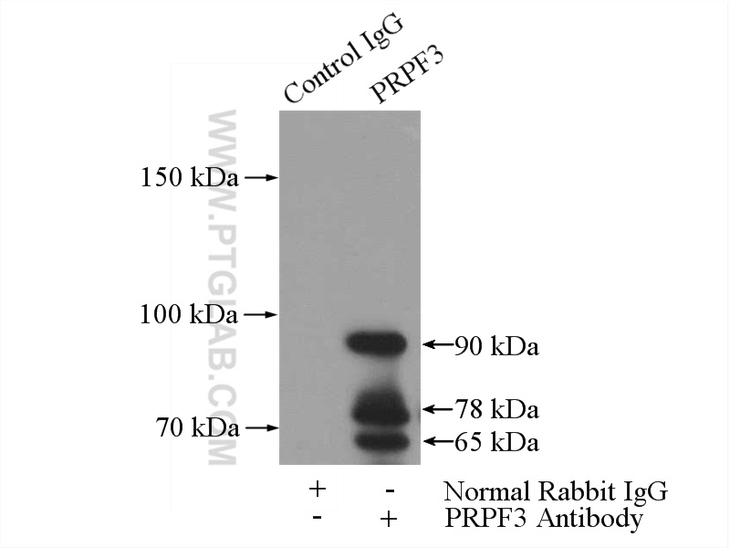 PRPF3 Polyclonal antibody