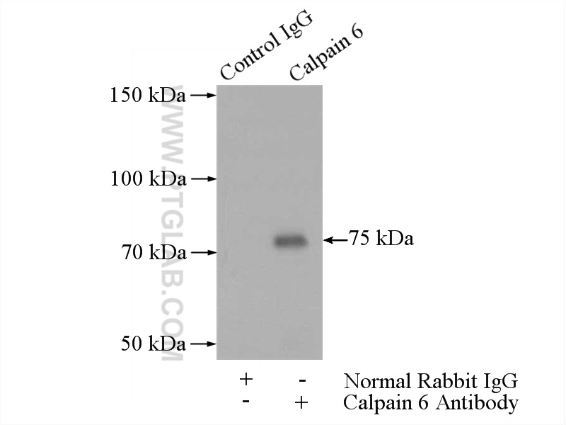 Calpain 6 Polyclonal antibody