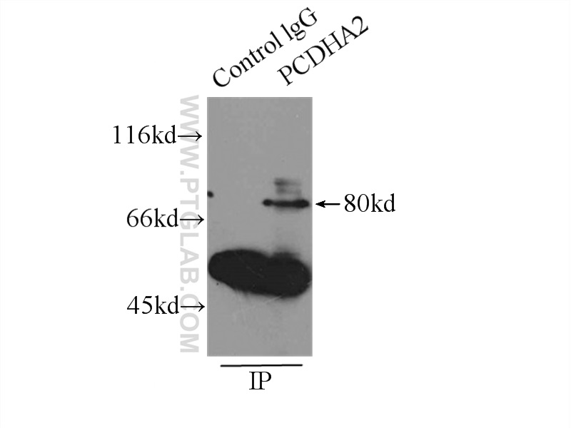 PCDHA2 Polyclonal antibody