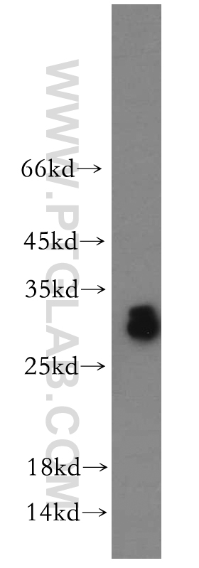 ASB9 Polyclonal antibody