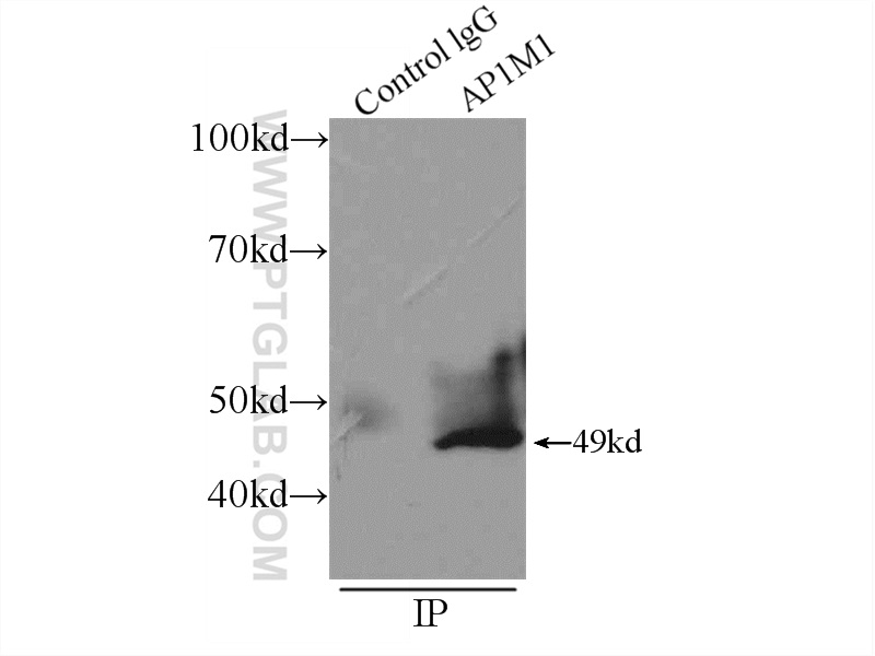 AP1M1 Polyclonal antibody