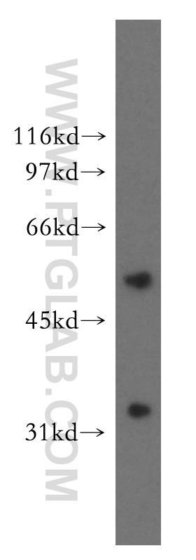 AKR7A3 Polyclonal antibody