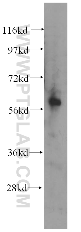AMIGO2 Polyclonal antibody