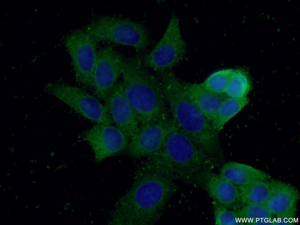 AKR1A1 Polyclonal antibody