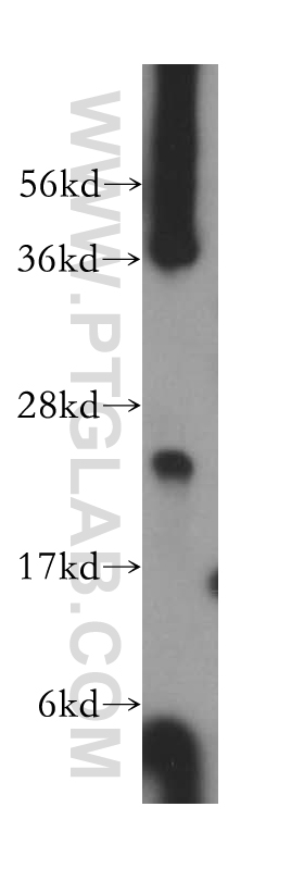 ARD1B Polyclonal antibody
