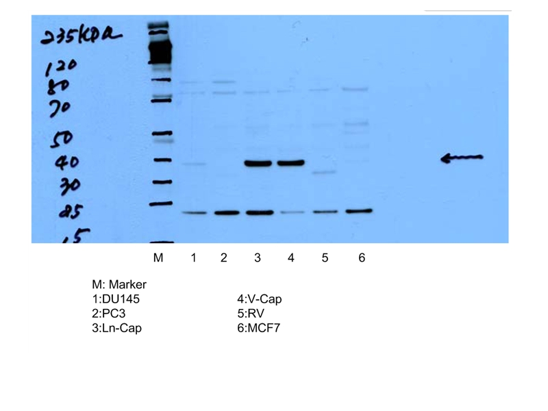 AMACR/p504S Polyclonal antibody