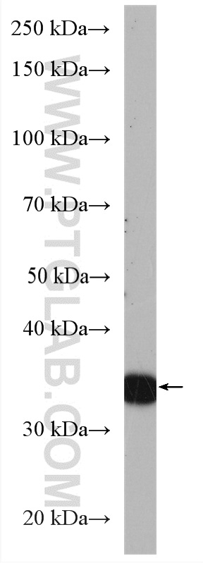 ASB1 Polyclonal antibody