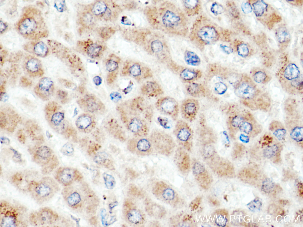 ACSM5 Polyclonal antibody