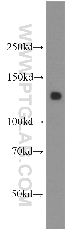 AMOT Polyclonal antibody