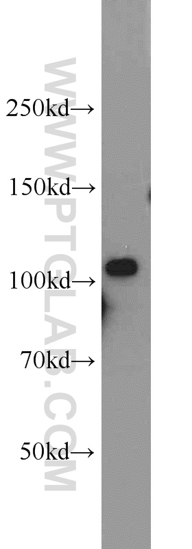AMOTL1 Polyclonal antibody