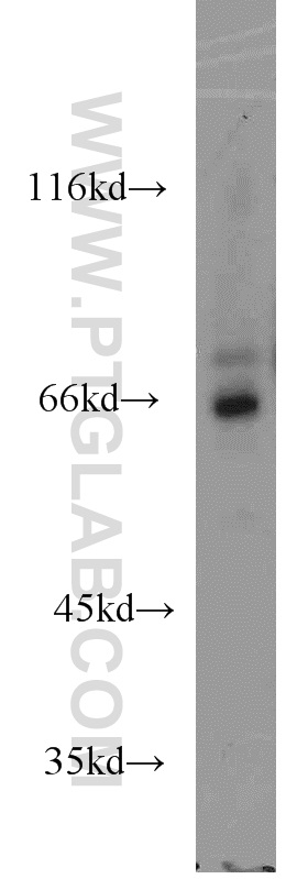 ADCK5 Polyclonal antibody