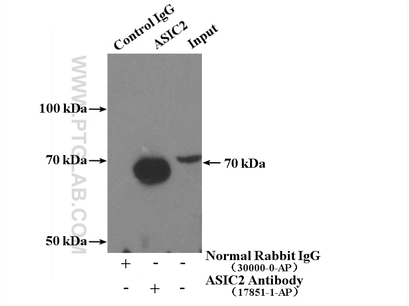 ASIC2 Polyclonal antibody
