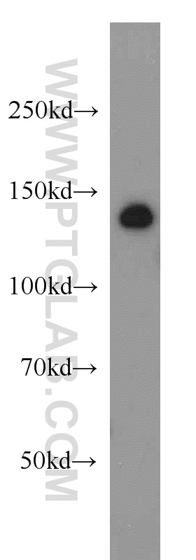 ADNP Polyclonal antibody