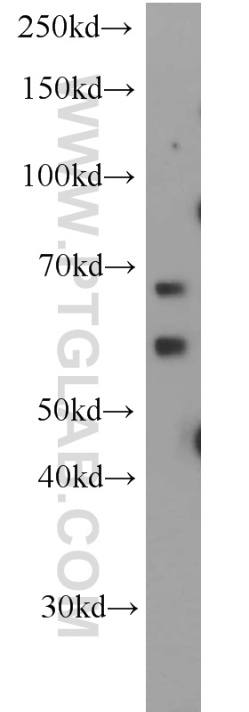 ALG6 Polyclonal antibody