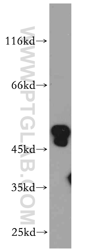 ANKMY2 Polyclonal antibody