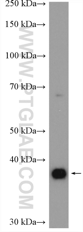 ADORA2B Polyclonal antibody