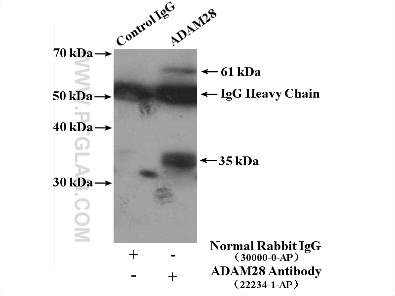 ADAM28 Polyclonal antibody