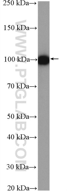 AMOTL2 Polyclonal antibody