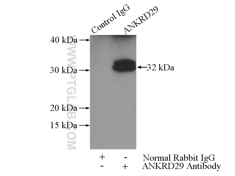 ANKRD29 Polyclonal antibody