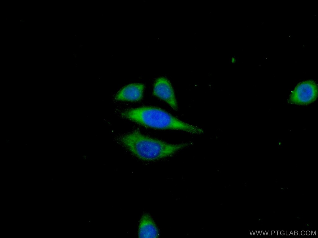 ANKRD39 Polyclonal antibody