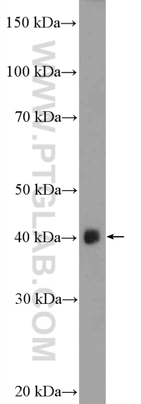 ASB5 Polyclonal antibody