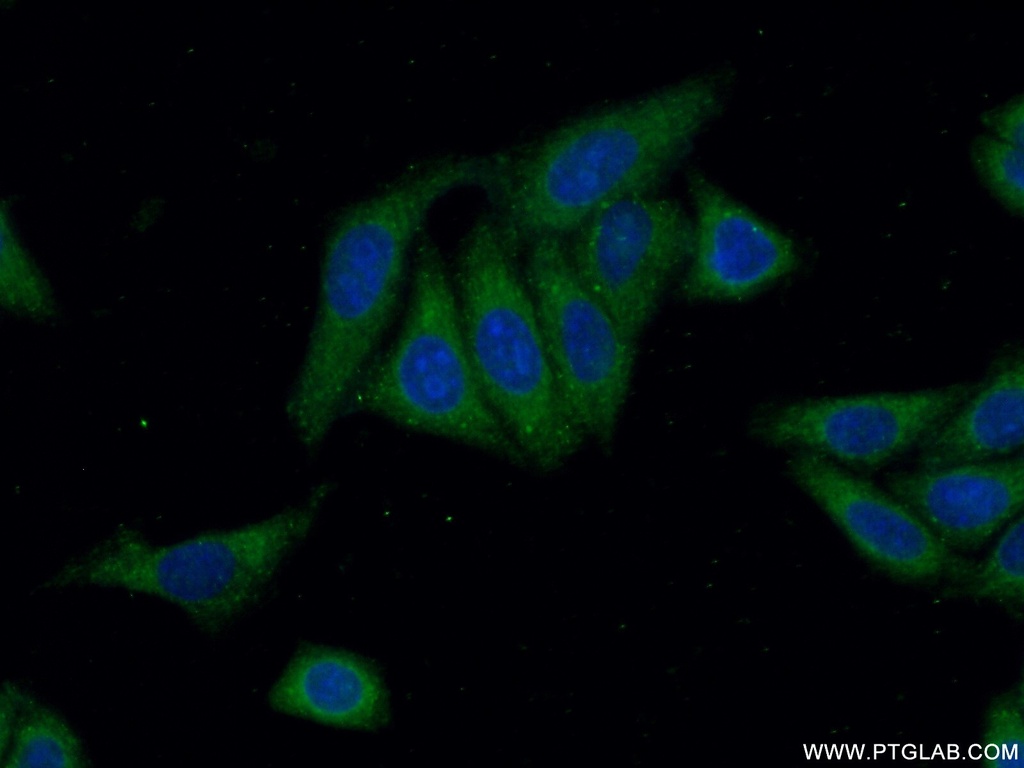 ANKRD53 Polyclonal antibody