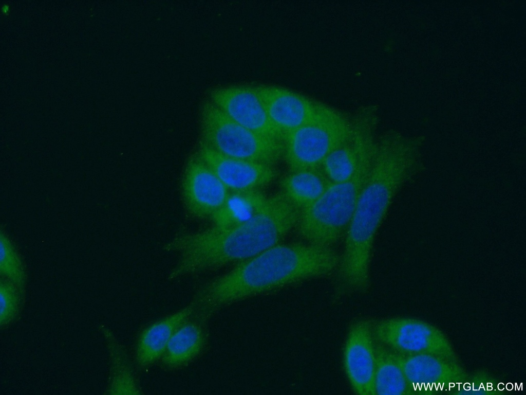 ANKRD16 Polyclonal antibody
