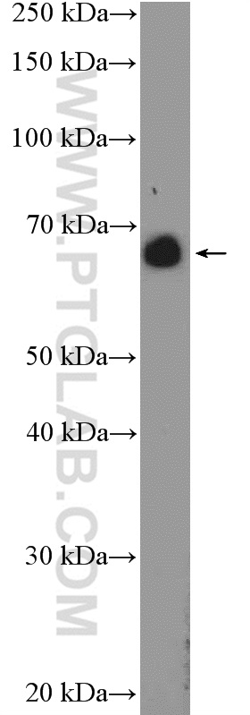 ANKRD34B Polyclonal antibody