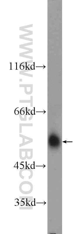 ARMC5 Polyclonal antibody