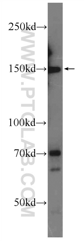 ATAD5 Polyclonal antibody