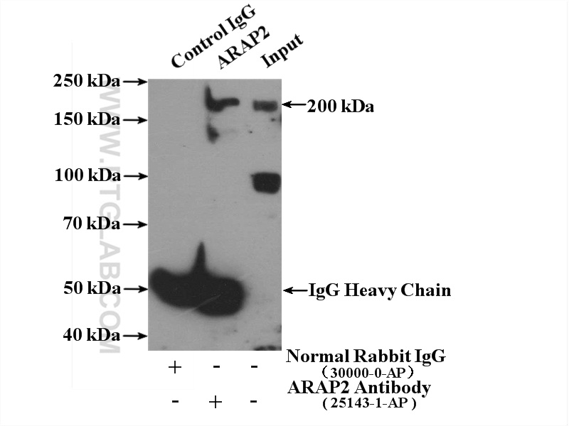 ARAP2 Polyclonal antibody