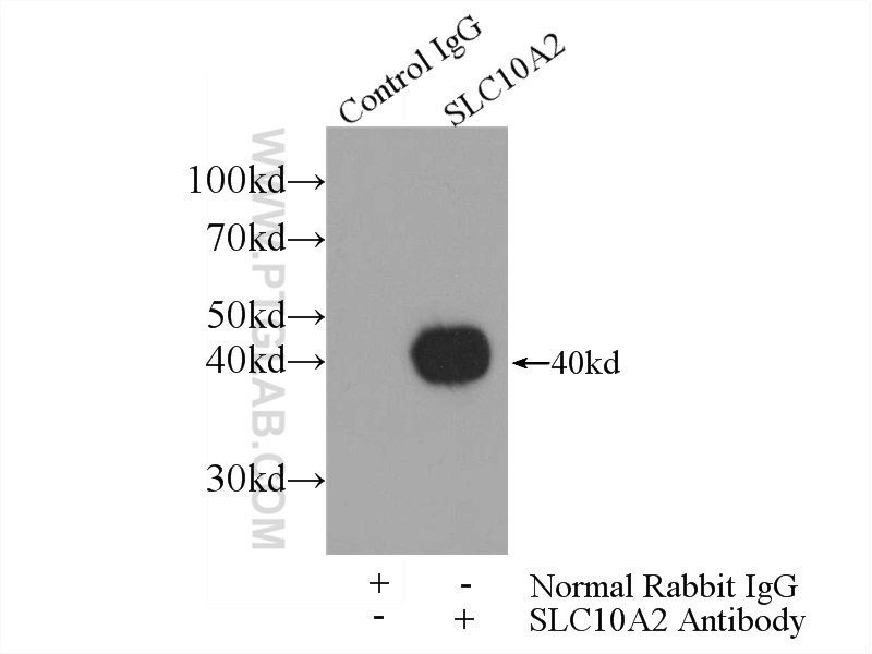 ASBT Polyclonal antibody