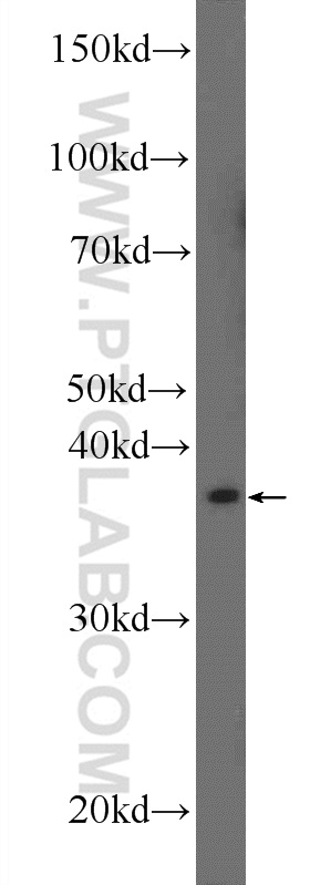AGPAT3 Polyclonal antibody