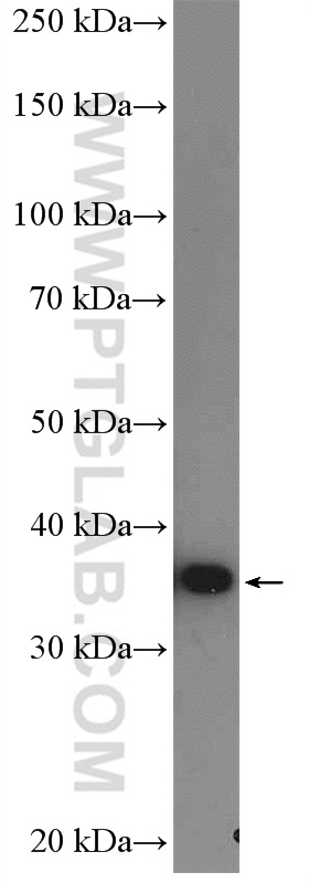 AMPK Beta 1 Polyclonal antibody