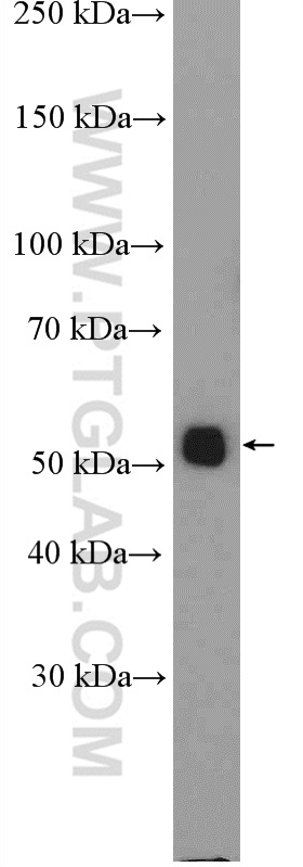 ALG11 Polyclonal antibody