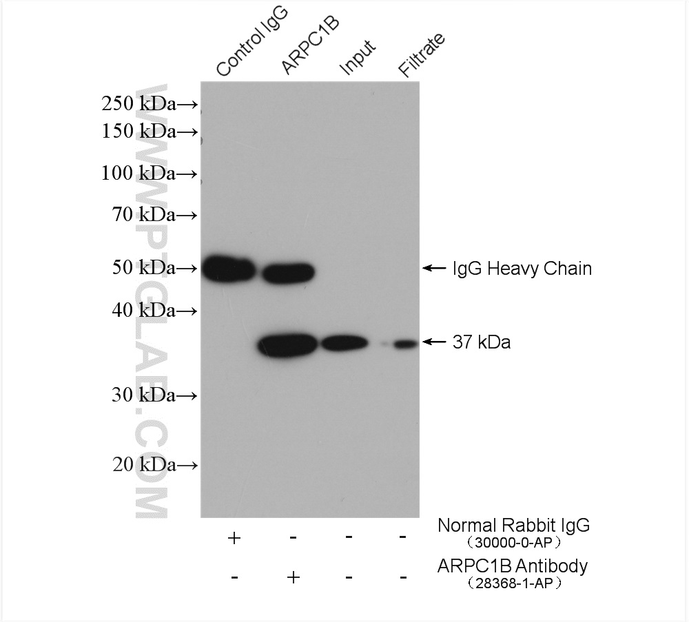 ARPC1B Polyclonal antibody
