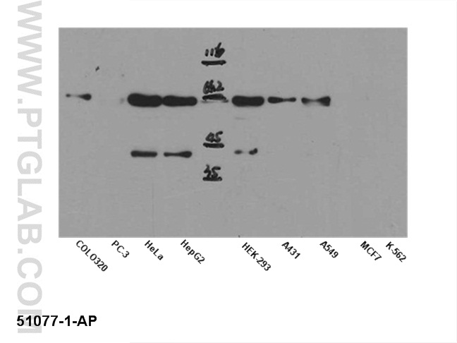 AKT1 Polyclonal antibody