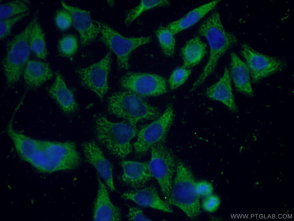 APOD Monoclonal antibody
