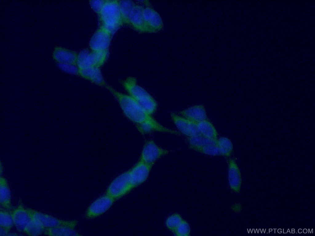 AP5Z1/SPG48 Monoclonal antibody