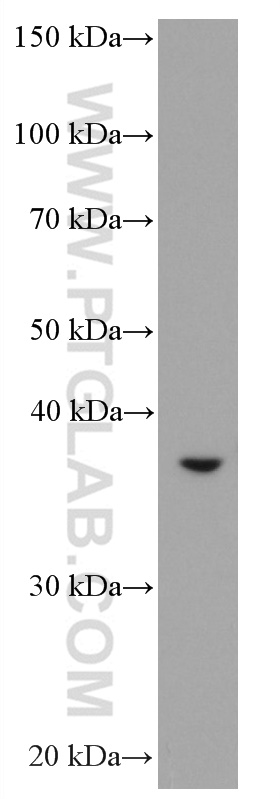 ASGR2 Monoclonal antibody