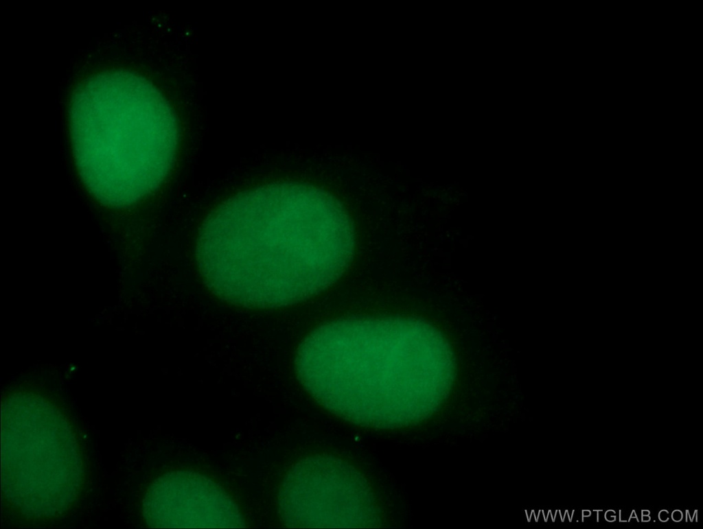 ASF1A Monoclonal antibody