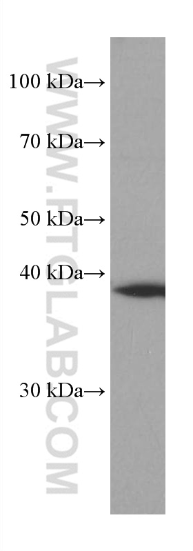 AIM2 Monoclonal antibody