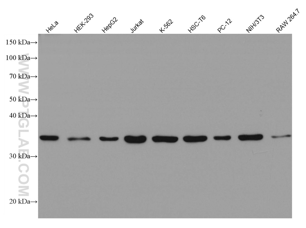 AMPK Gamma 1 Monoclonal antibody