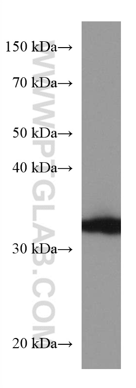 AKR1B1 Monoclonal antibody