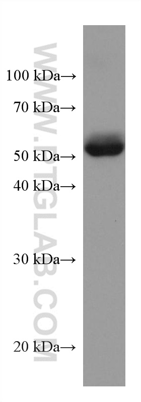 ANGPTL4 Monoclonal antibody