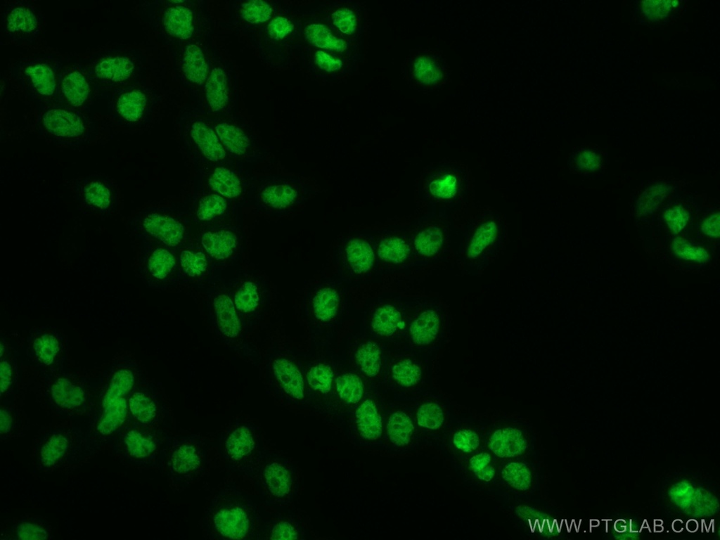 ANP32A Monoclonal antibody