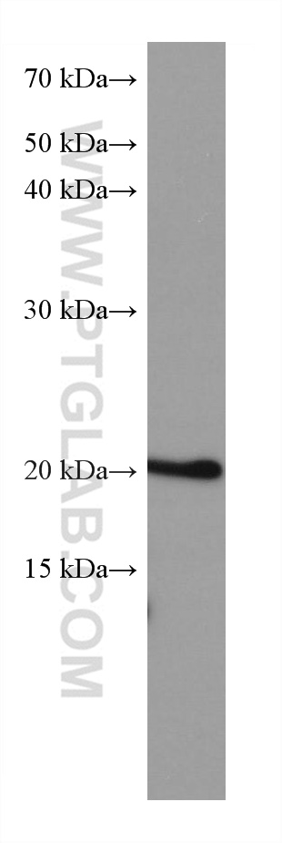 ARL8B Monoclonal antibody
