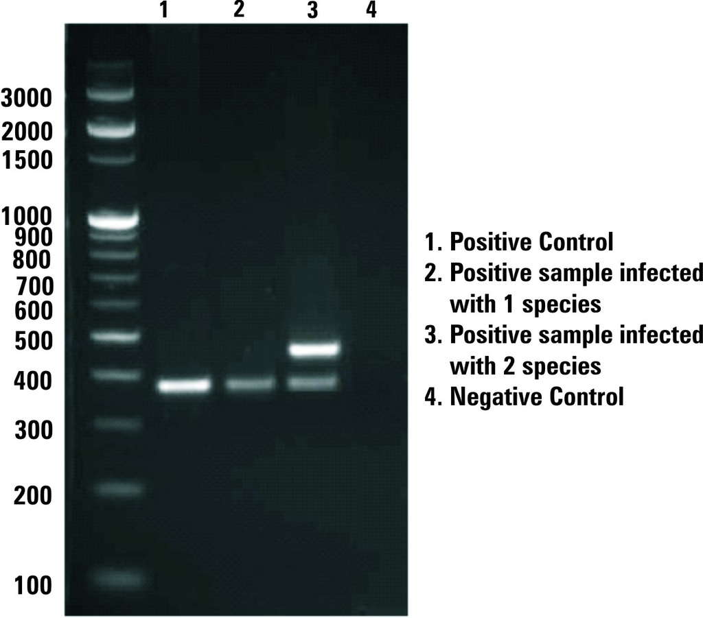 EZdetectTM PCR kit for Mycoplasma detection
Based on 16S-23S rRNA spacer region     