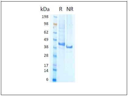 [HZ-1109-100UG] HumanKine® recombinant human LEFTY-1 protein