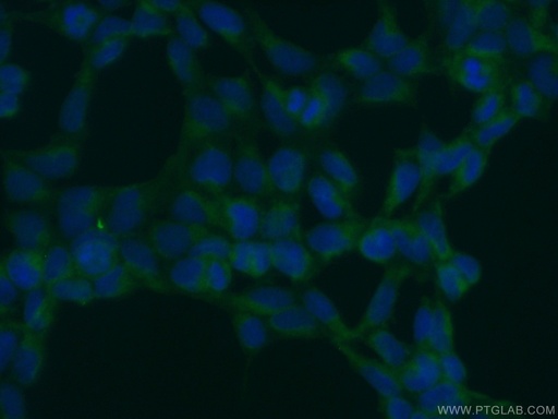 [10061-1-AP-150UL] OS9 Polyclonal antibody